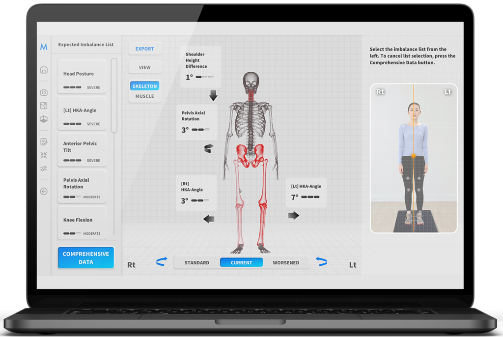 Promo Postural Screening Moti Physio – Samase Physio Bintaro